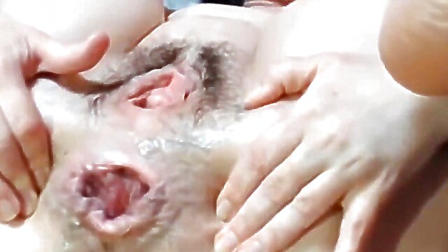 Mature amateur anal prolapse, extreme amateur anal, amateur prolapse, extreme wife anal, rough mature wife, extreme sex anal